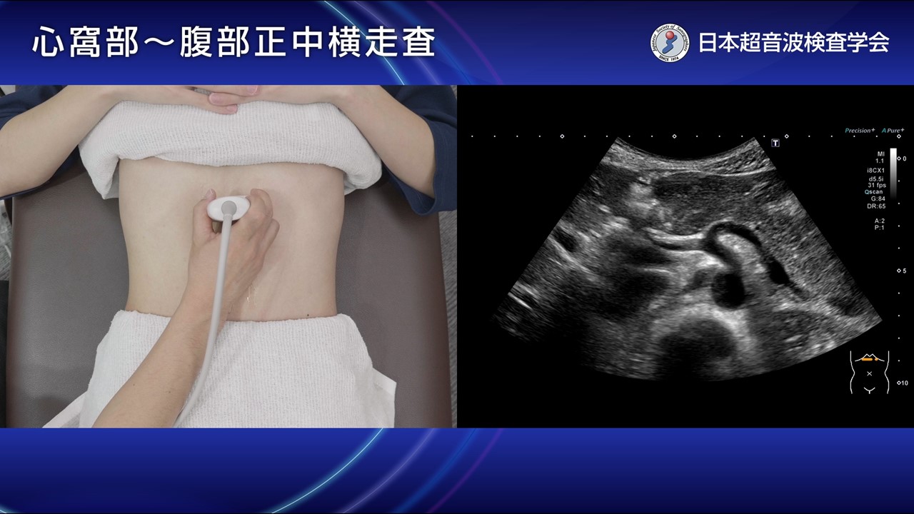 16. 腹部正中横走査