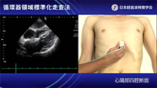 心窩部四腔断面