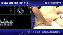 ドプラ法（パルスドプラ法）左室流入血流波形