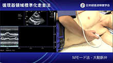 Ｍモード法（大動脈弁）