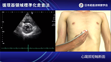 心窩部短軸断面